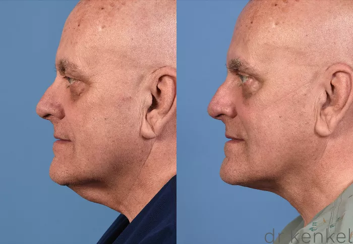 【裁断済み】外傷形成外科 Emergency Plastic Surgery ZPlasty Case #222